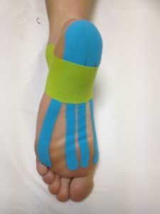 K-taping